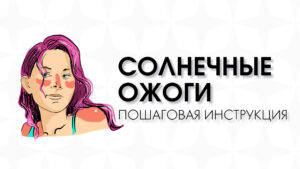 Солнечные ожоги — Трушина Анна Алексеевна, дерматолог, трихолог клиники Огни Олимпа